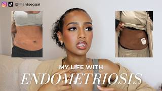 Endometriosis QampA  my story symptoms and surgery 10 years of pain [upl. by Stern]