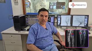 Lets Talk about Digital Subtraction Angiography [upl. by Meara]