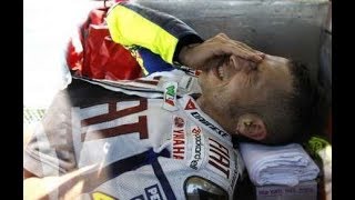 Valentino Rossi operato per la frattura di tibia e perone Addio mondiale [upl. by Imelda489]