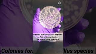 Bacterial Colonies on AgarSolid Medium I Bacillus species I shorts [upl. by Liederman243]