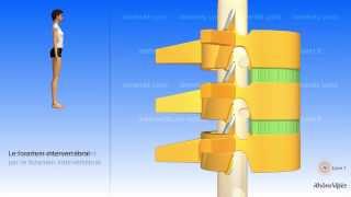 La colonne vertébrale simplifiée et la vertèbre type [upl. by Alvord]