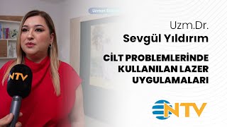 UZMDR SEVGÜL YILDIRIM  NTV  Cilt problemlerinde kullanılan lazer uygulamaları [upl. by Odin179]