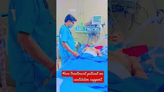 live treat patients on ventilator support ajeetsingh medical ki duniya short [upl. by Htilil]