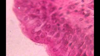 Pseudostratified Columnar Epithelium [upl. by Augie]