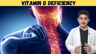 Rickets disease 3d animation  cause symptoms pathology  vitamin D deficiency in children  hindi [upl. by Mundy]