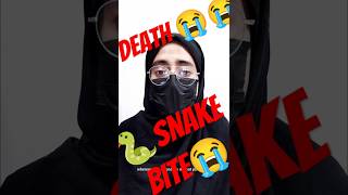 Snake🐍bite youtubecreators 5MinuteCraftsYouTube yrf LOLBrainRot LittleBabyBum HUMTV [upl. by Casteel]