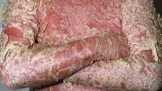 Erythrodermic psoriasis images photos pictures erythroderma symptoms [upl. by Anihtyc]