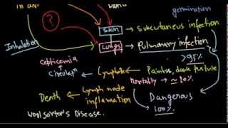 Bacillus anthracis infection [upl. by Odarbil]