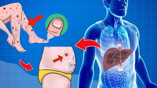 8 Weird Signs That Show Youre Having Liver Damage  Liver Disease Signs [upl. by Enilra]