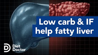 Low carb and intermittent fasting help fatty liver [upl. by Ardnaik]