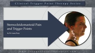 Sternocleidomastoid SCM Pain and Trigger Points [upl. by Ainecey]