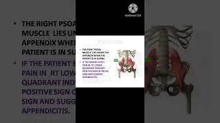 PSOAS SIGNshorts Nursing Wisdom [upl. by Natalya]