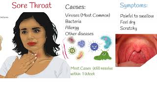 Sore Throat  Causes symptoms and management viral vs bacterial sore throat [upl. by Espy]