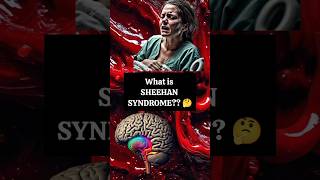 Whats SHEEHAN SYNDROME  Obstetrics  education mbbs biology medicalstudent medicine study [upl. by Durwin]