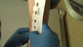 Skin Prick Allergy Testing ResultsNorthwest ENT and Allergy [upl. by Amasa]