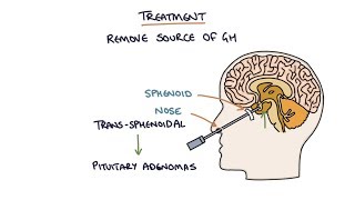 Understanding Acromegaly [upl. by Chastain]