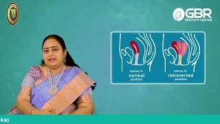 What is Retroverted Uterus பின்னோக்கிய கருப்பை குழந்தையின்மைக்கு காரணமா Dr Buvaneswari Explains [upl. by Montanez333]