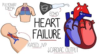 Heart Failure Explained  HFrEF vs HFpEF Systolic vs Diastolic Heart Failure [upl. by Nhguaved]