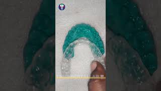 Toothsi  Dentist Lab World  Orthodontics Teeth Treatment  Painless  Tamil Dental Lab🦷dentallab [upl. by Babette]