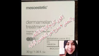 شرح اقوى كريم لعلاج الكلف و النمش شرح التفشير بالبارد dermamelan treatment [upl. by Gerk681]