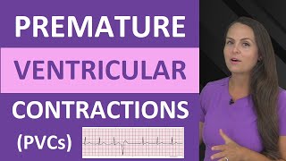 Premature Ventricular Contractions PVCs ECG Nursing NCLEX Bigeminy Trigeminy [upl. by Rawlinson]