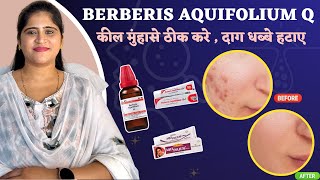 Berberis Aquifolium Q for Acne amp Pigmentation Best Homeopathic Medicine  Dr Arwa Bohra [upl. by Sonny]