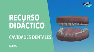 Clasificación de las cavidades dentales según Black [upl. by Nodnyl368]