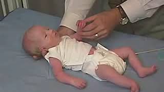 Babinski Reflex Assessment in Newborn Infant  Pediatric Nursing Clinical Skills [upl. by Amandi675]