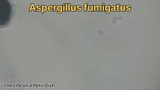 Aspergillus niger fumigatus and flavus [upl. by Sirraj119]