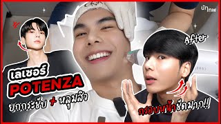 รีวิว ทำ POTENZA ทุกขั้นตอน หน้ายกหลุมสิวหาย ในเครื่องเดียว ปังเกิ้นนนน  NUTTHEP [upl. by Anizor]