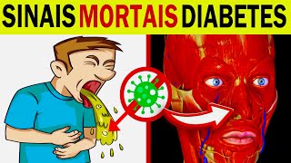 7 SINAIS MORTAIS de DIABETES que Você Não Pode Ignorar Cetoacidose Diabética [upl. by Cordy]