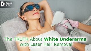 Myth or Fact Can laser hair removal procedure whiten underarmsDr Rashmi RavindraDoctors Circle [upl. by Lothair]