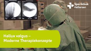 Hallux valgus – Moderne Therapiekonzepte [upl. by Sokil]