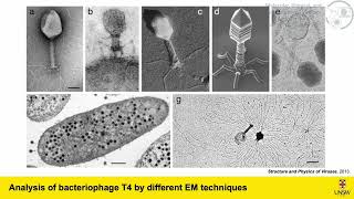 CryoElectron Microscopyof Viral Particles [upl. by Eniluqaj]