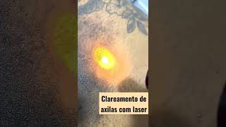 CLAREAMENTO DE AXILAS COM LASERlaserclareamentodeaxilasaxilaslivrespelesensivel [upl. by Zimmer]