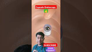 What is Capsule Endoscopy healthsciences endoscopy science [upl. by Nahtnoj]