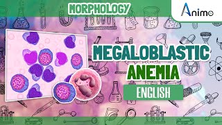 Megaloblastic Anemia  Histo pathology  RBC Morphology  English [upl. by Eilraep]