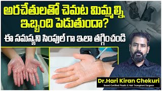 Hyperhidrosis Treatment in Telugu  How to Cure Sweaty Palms Permanently  ReDefine Channel [upl. by Mharg306]