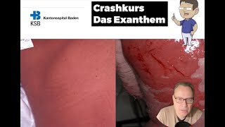 KSB Dermatologie Kurs 4 das Exanthem [upl. by Sergei]