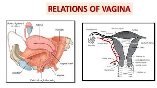 Structure Relations of the vagina Anterior posterior lateral relations during vaginal examination [upl. by Kaasi]