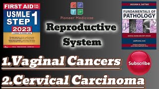 Usmle step 1Vaginal tumorsCervical carcinoma from PathomaReproductive system pathologyUrduHindi [upl. by Tutt]