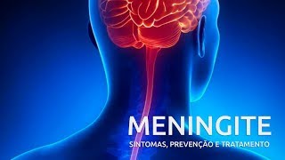 Meningite – sintomas prevenção e tratamento  Sua Saúde na Rede [upl. by Annailuj531]