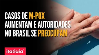 MINISTÉRIO DA SAÚDE VAI SE REUNIR PARA DISCUTIR SOBRE AUMENTO DE CASOS DE MPOX NO BRASIL [upl. by Drape]