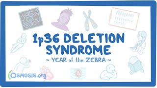 1p36 deletion syndrome Year of the Zebra [upl. by Campos]