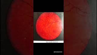 Diagnosis learnwithme studyshorts optometry optometrists fypシ゚viral [upl. by Maribeth]