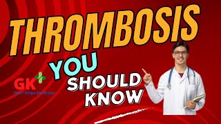 What Is Thrombosis  Bloodclot Kya Hai sapnajoshi5147 [upl. by Eslehc625]