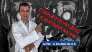 O nervo olfatório na ressonância magnética  Radiologia e a Anosmia shorts [upl. by Ketti]