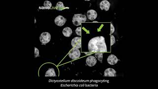 Amoeba defeats Escherichia coli bacteria [upl. by Aitsirk]