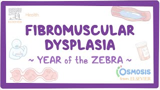 Fibromuscular dysplasia Year of the Zebra [upl. by Iverson241]