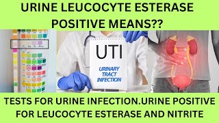 URINE EXAMINATION LEUCOCYTE ESTERASE POSITIVE UTI URINARY NITRITE AND LEUCOCYTE ESTERASE POSITIVE [upl. by Allyson]